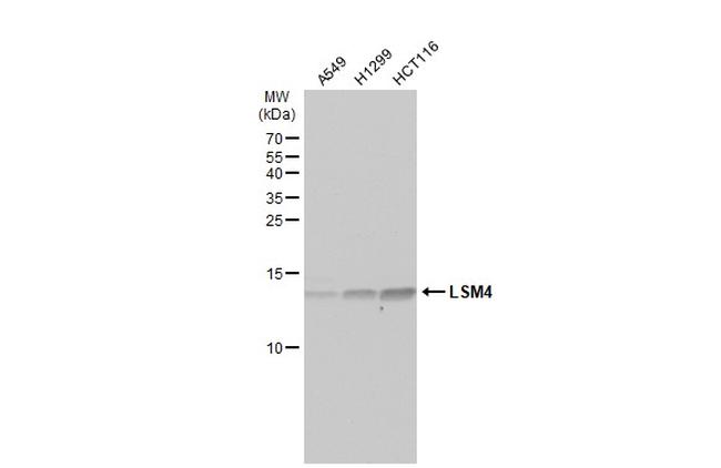LSM4 Antibody in Western Blot (WB)