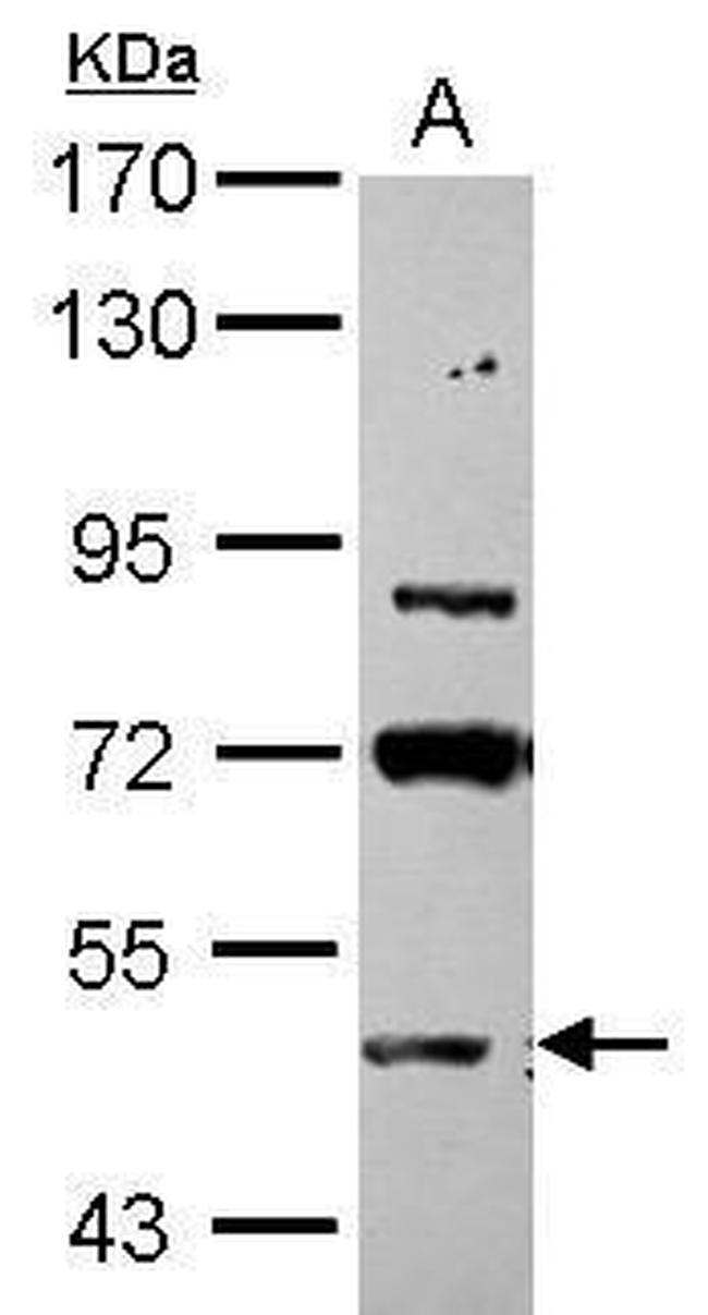 ASB3 Antibody in Western Blot (WB)