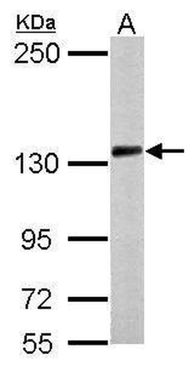 PCDH10 Antibody in Western Blot (WB)