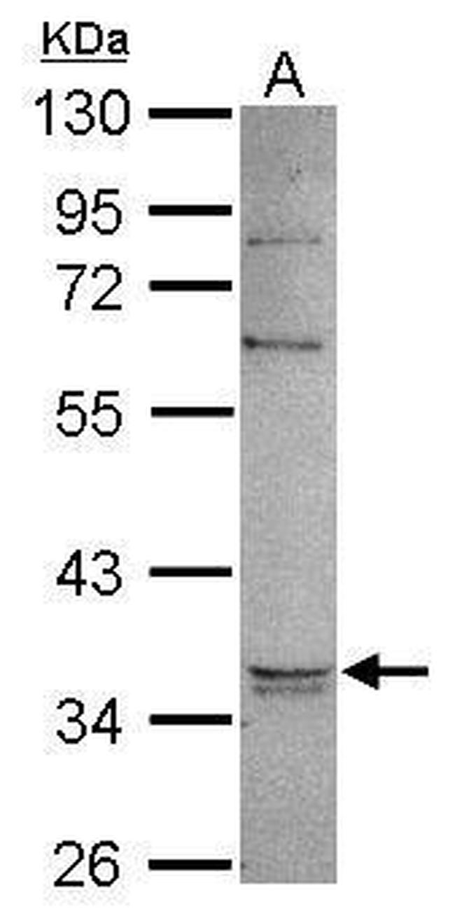 GPD1 Antibody in Western Blot (WB)