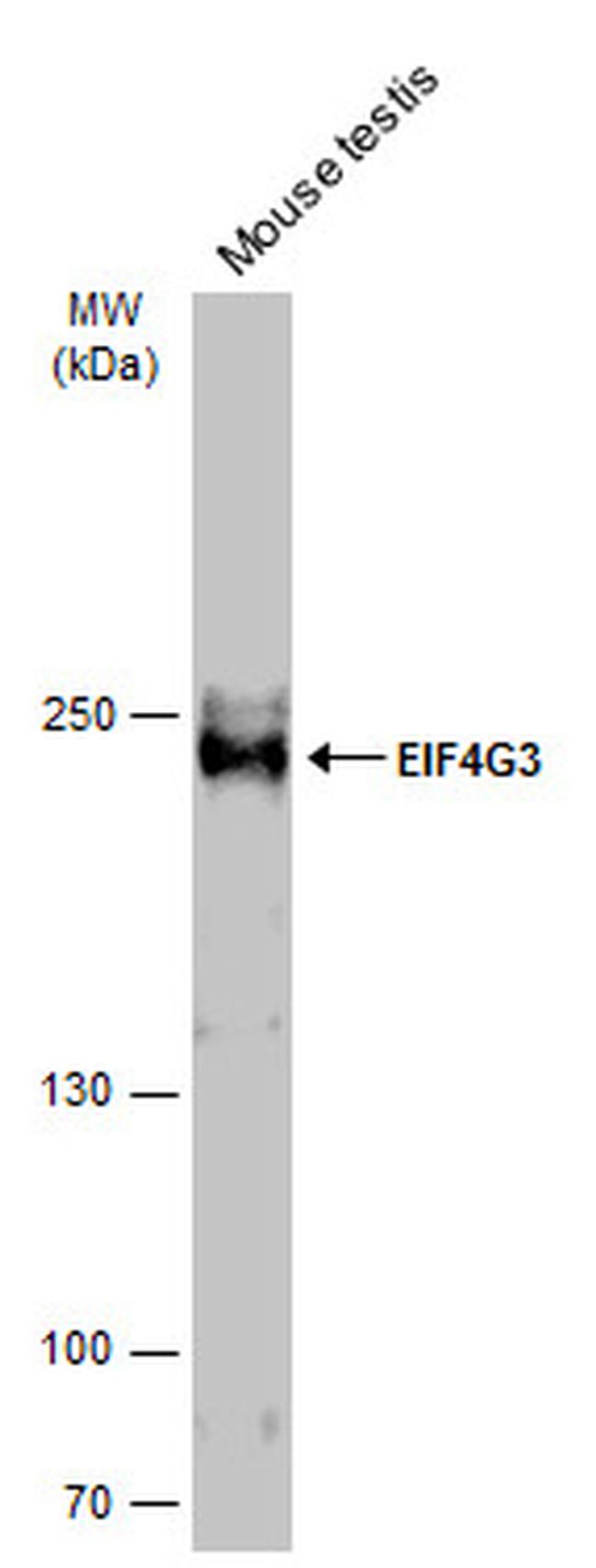 eIF4G3 Antibody in Western Blot (WB)