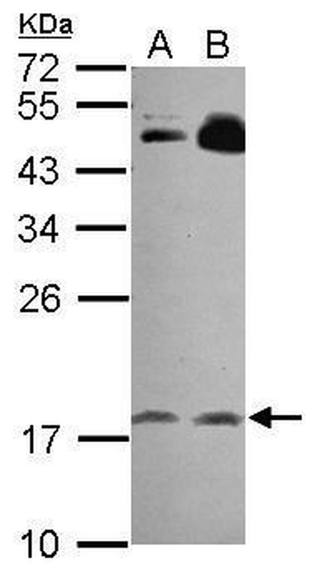 RGS8 Antibody in Western Blot (WB)