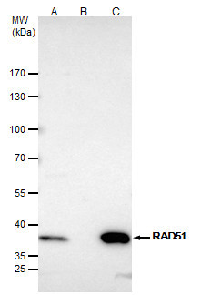 RAD51 Antibody in Immunoprecipitation (IP)