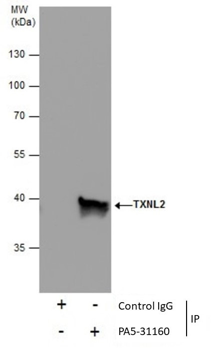 TXNL2 Antibody in Immunoprecipitation (IP)