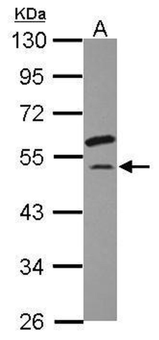 eIF2 gamma Antibody in Western Blot (WB)