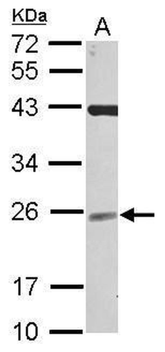 NCE2 Antibody in Western Blot (WB)