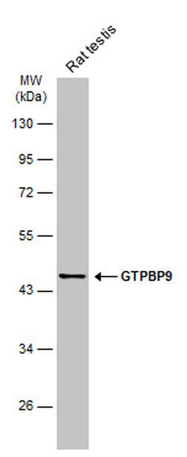 GTPBP9 Antibody in Western Blot (WB)