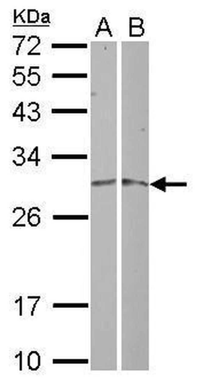 MRPL19 Antibody in Western Blot (WB)