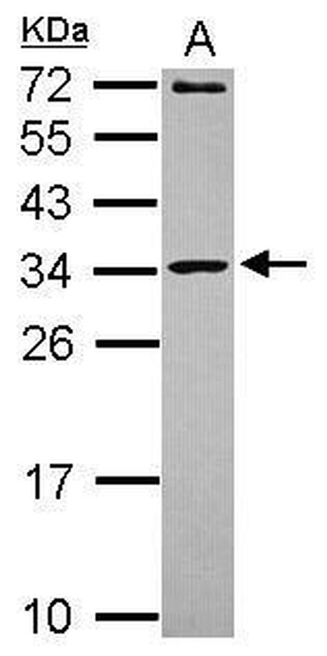 MRPL10 Antibody in Western Blot (WB)