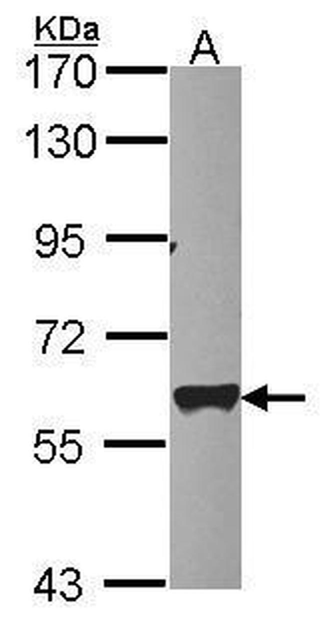 MTPAP Antibody in Western Blot (WB)