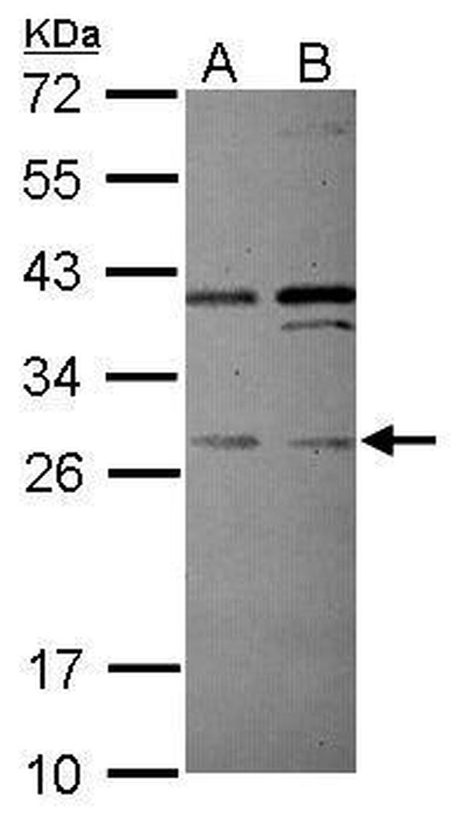 PLEKHF2 Antibody in Western Blot (WB)