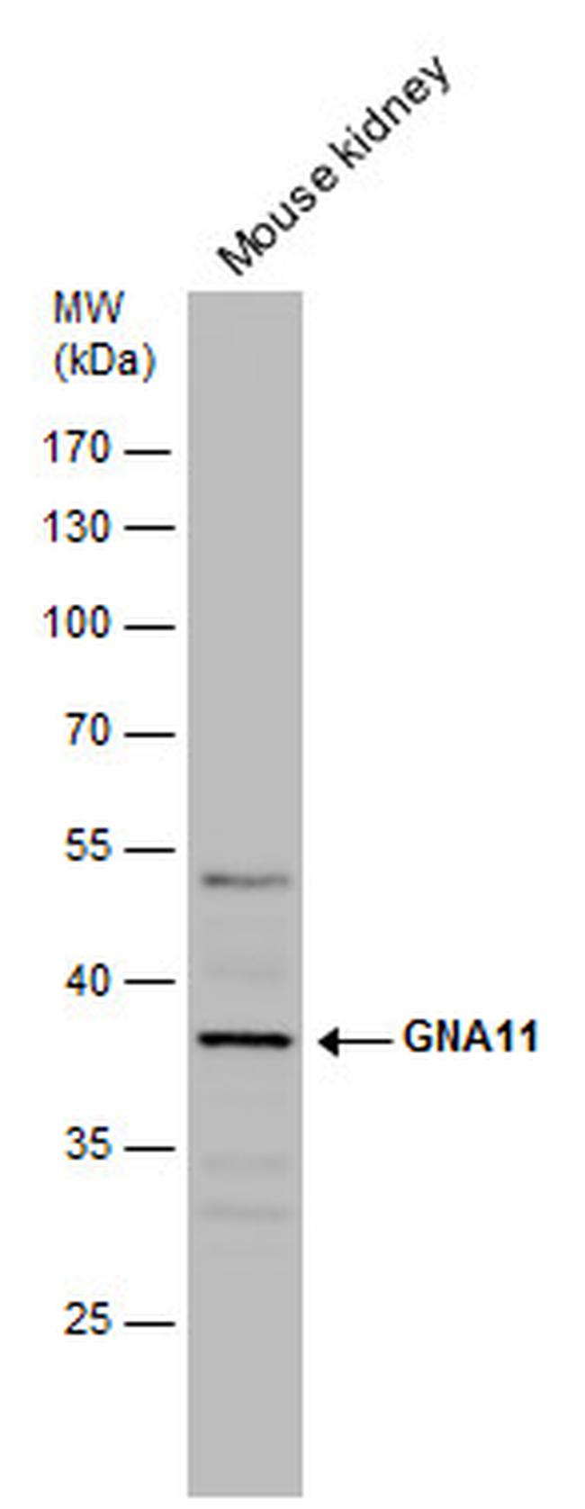 GNA11 Antibody in Western Blot (WB)