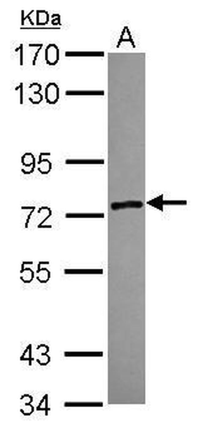 ZSWIM2 Antibody in Western Blot (WB)