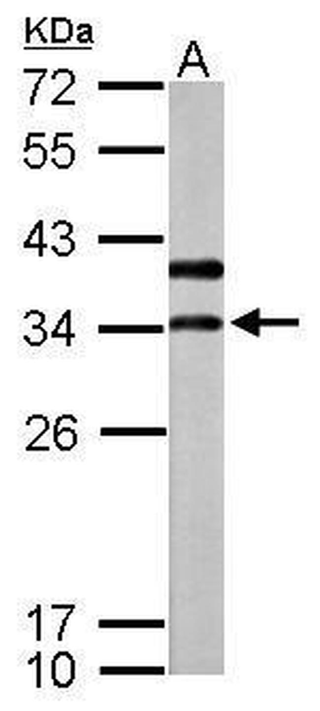 V-ATPase D Antibody in Western Blot (WB)