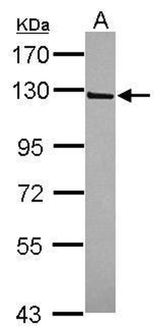 IFT122 Antibody in Western Blot (WB)