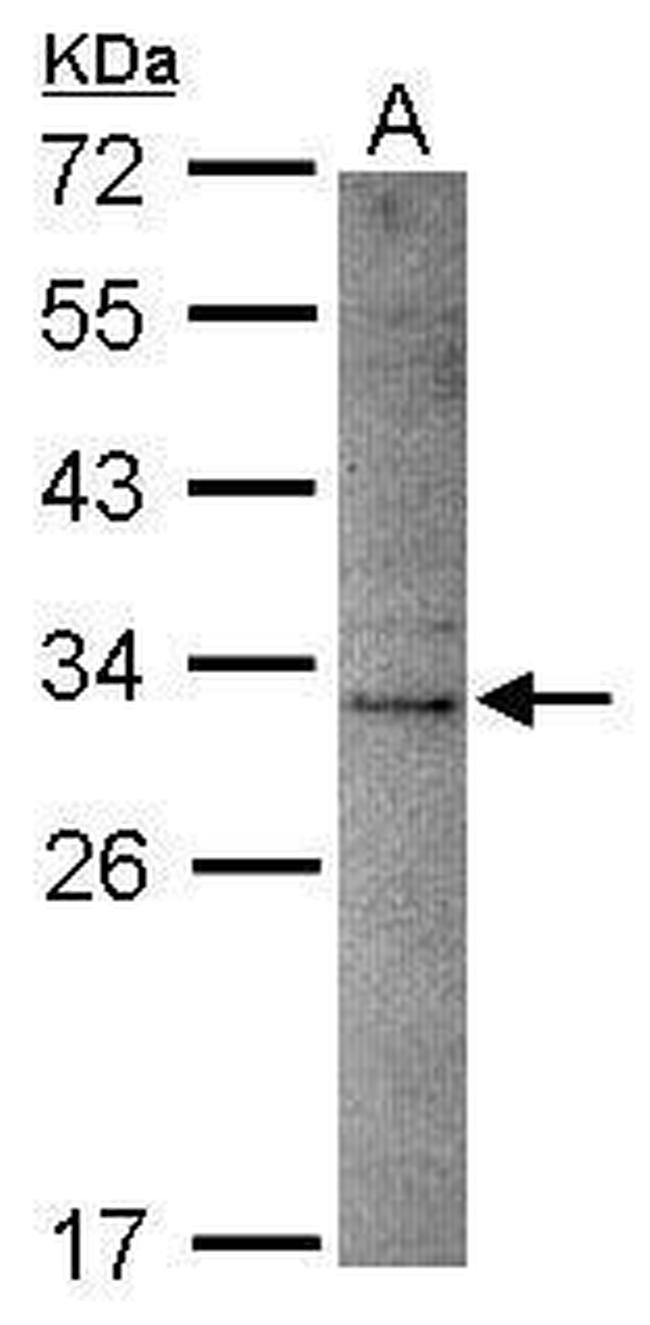 DNASE2B Antibody in Western Blot (WB)