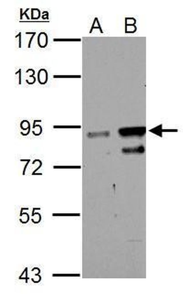 ZNF598 Antibody in Western Blot (WB)