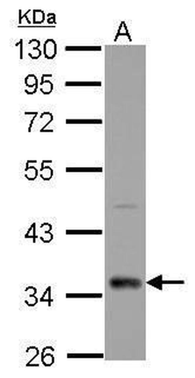 CPXCR1 Antibody in Western Blot (WB)