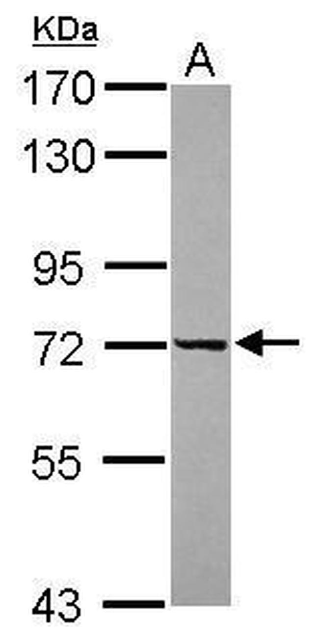 DDX43 Antibody in Western Blot (WB)