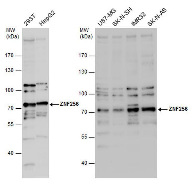 ZNF256 Antibody in Western Blot (WB)