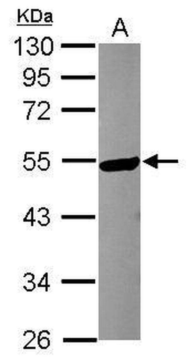 KATNA1 Antibody in Western Blot (WB)