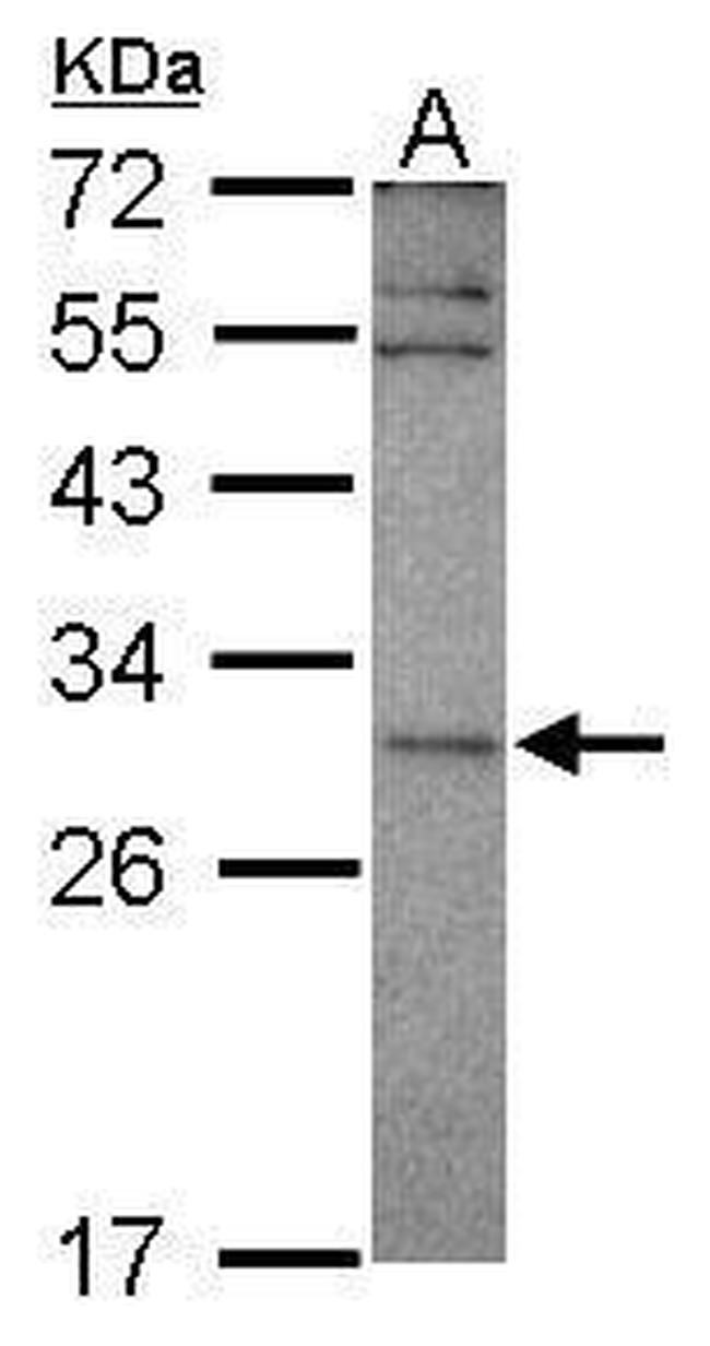 EAP30 Antibody in Western Blot (WB)