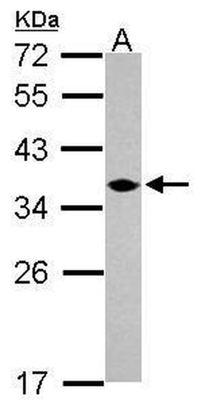 C1orf74 Antibody in Western Blot (WB)