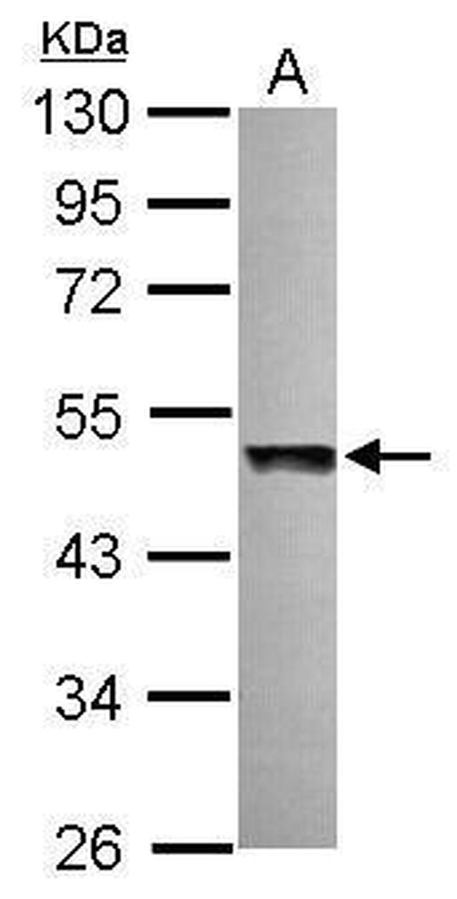 UBAC1 Antibody in Western Blot (WB)