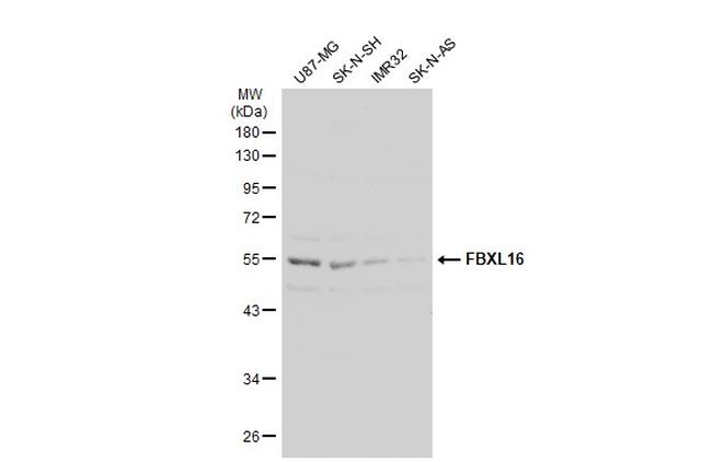 FBXL16 Antibody in Western Blot (WB)