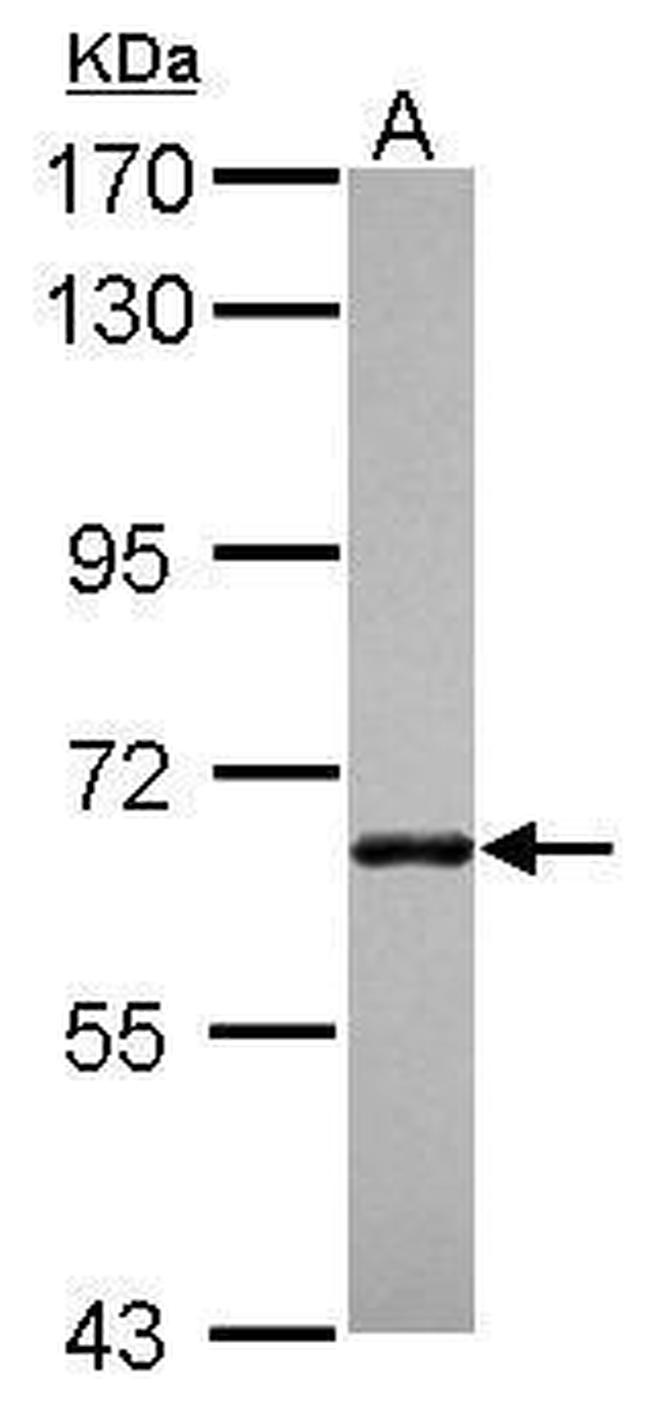 ANKRD13B Antibody in Western Blot (WB)
