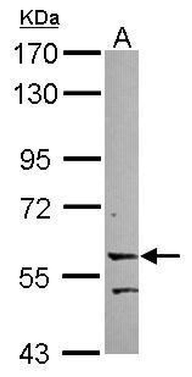 LRRC15 Antibody in Western Blot (WB)