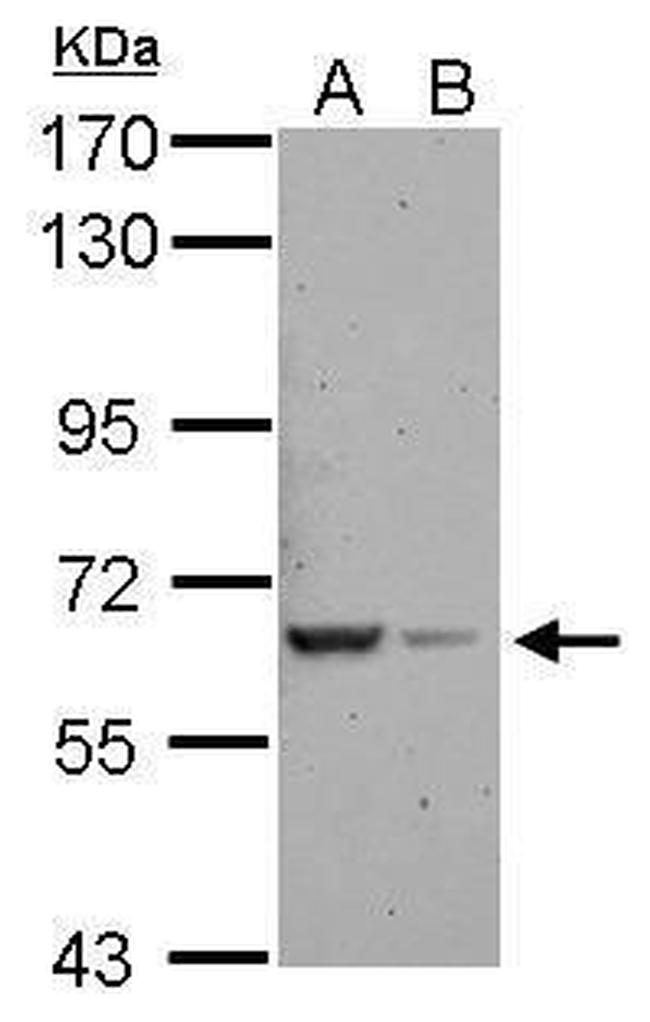 RAB11FIP5 Antibody in Western Blot (WB)