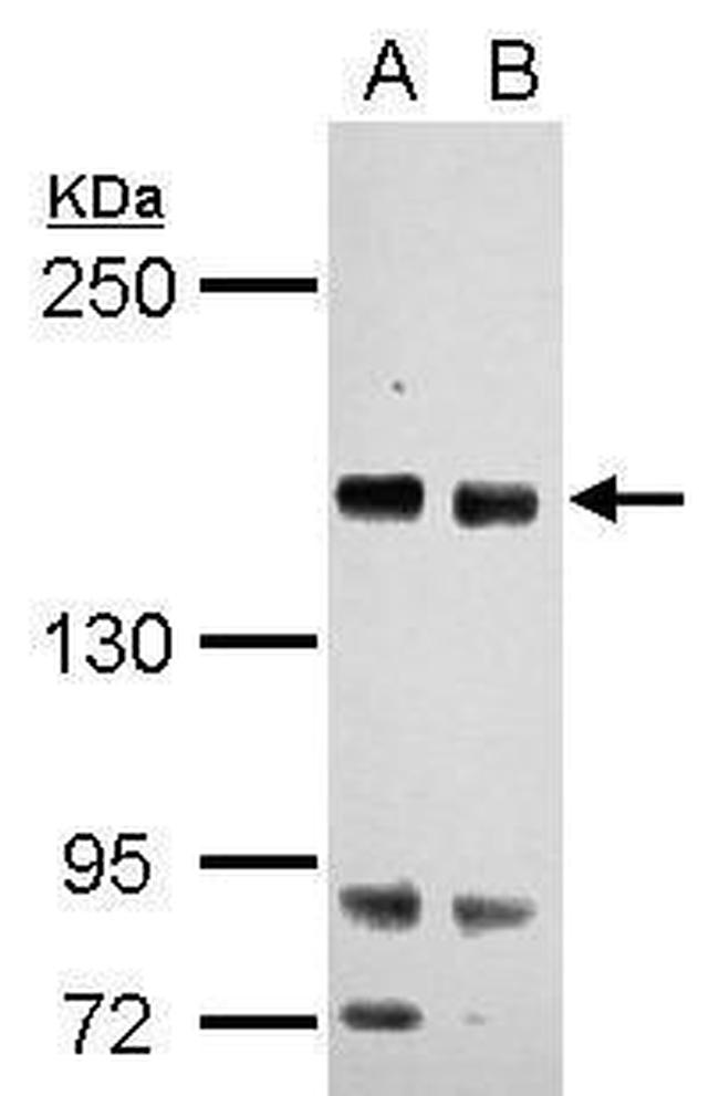 RASAL2 Antibody in Western Blot (WB)
