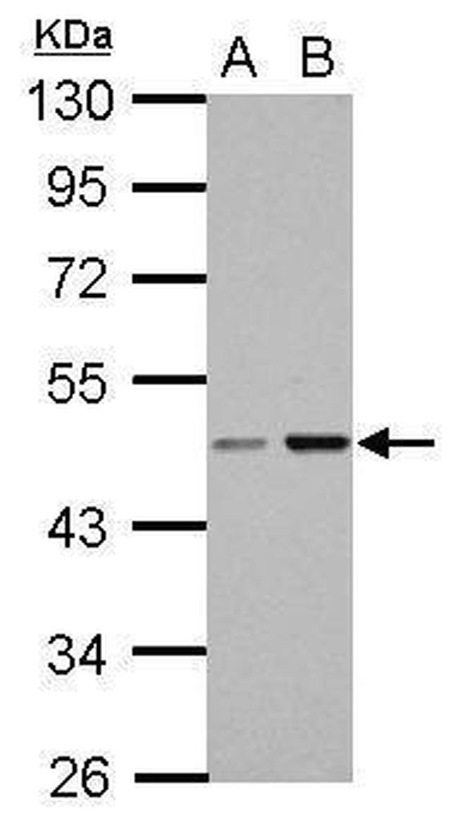 CC2D2B Antibody in Western Blot (WB)
