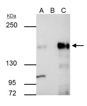 KDM6A Antibody in Immunoprecipitation (IP)