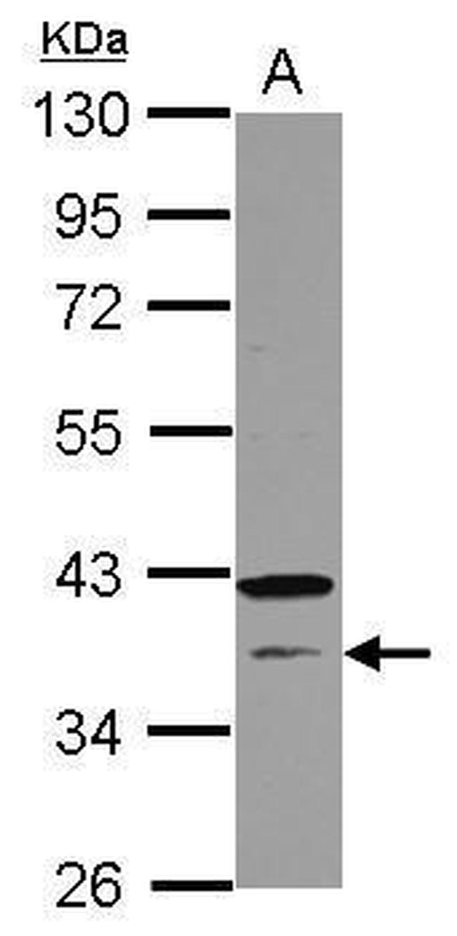 CNTD1 Antibody in Western Blot (WB)