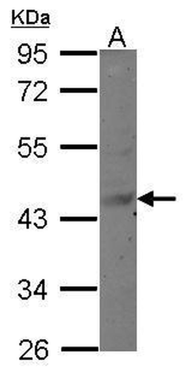 MAGEB6 Antibody in Western Blot (WB)