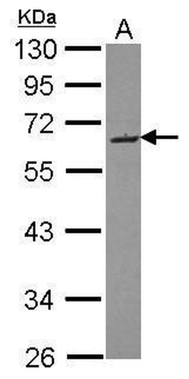 SMOC2 Antibody in Western Blot (WB)