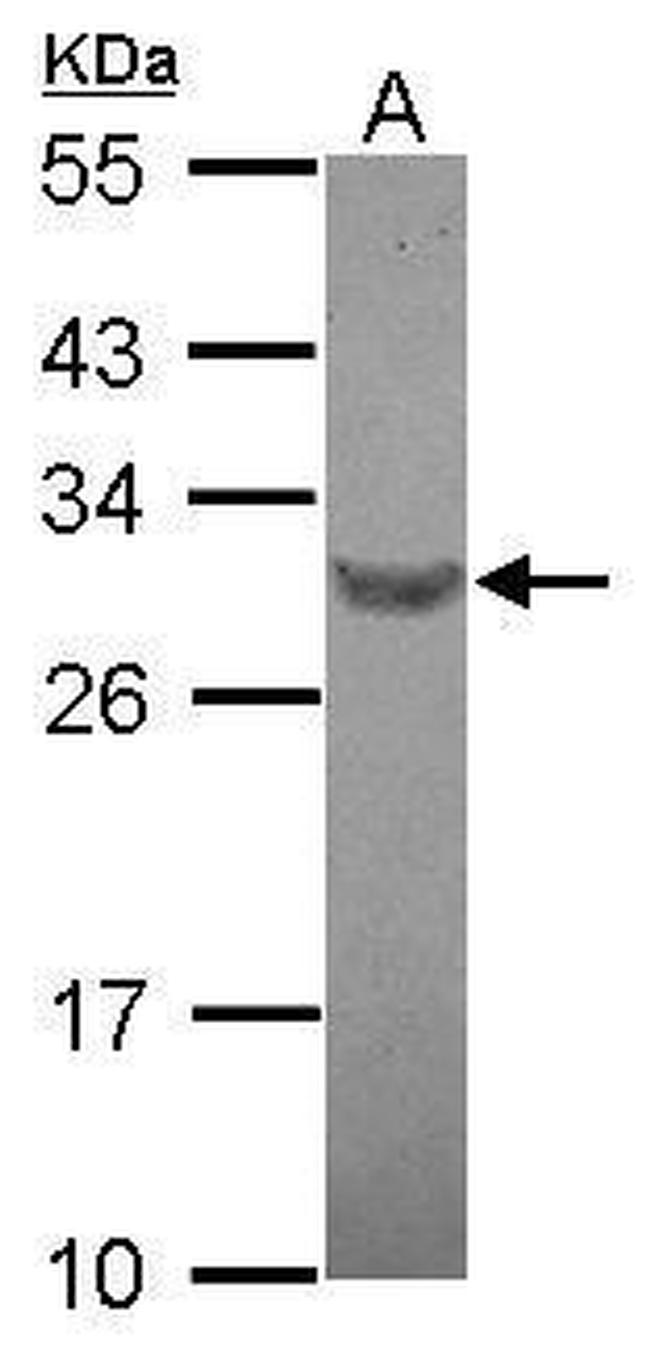RFPL4B Antibody in Western Blot (WB)