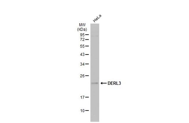 DERL3 Antibody in Western Blot (WB)