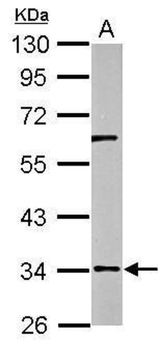RPUSD3 Antibody in Western Blot (WB)