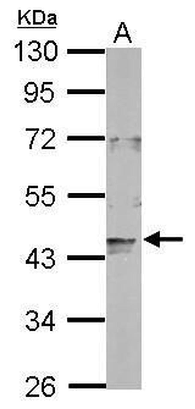 LONP2 Antibody in Western Blot (WB)