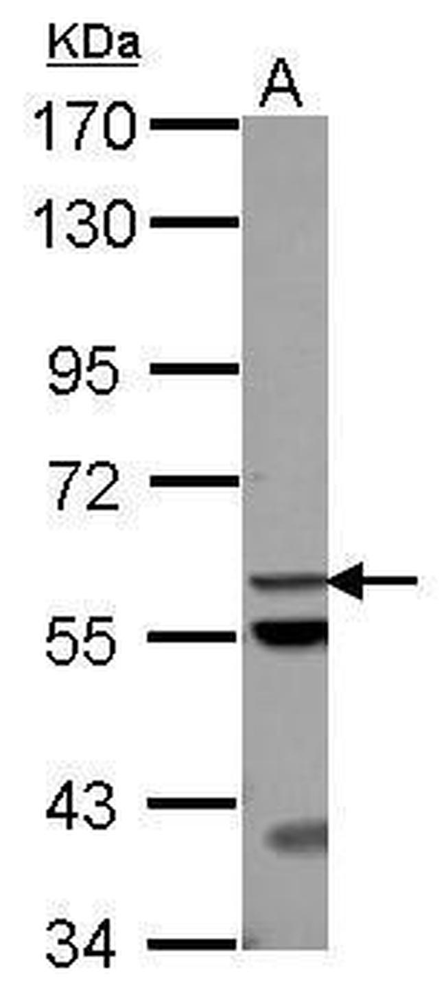 ACOT12 Antibody in Western Blot (WB)