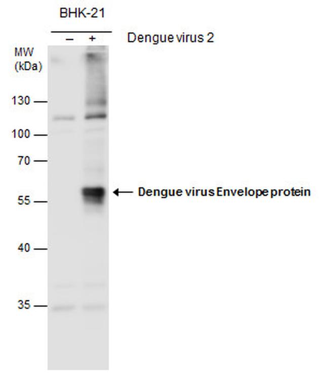 Dengue Virus Type 2 Envelope Antibody in Western Blot (WB)