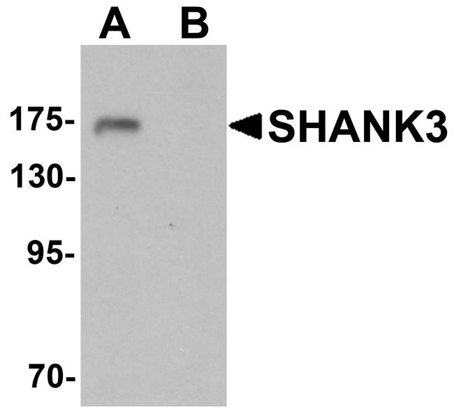 SHANK3 Antibody in Western Blot (WB)