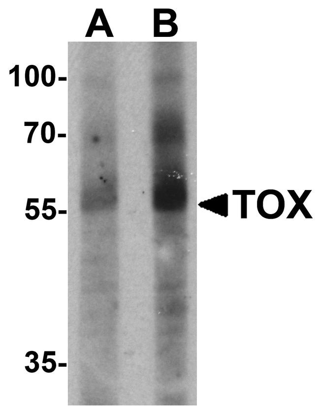 TOX Antibody in Western Blot (WB)