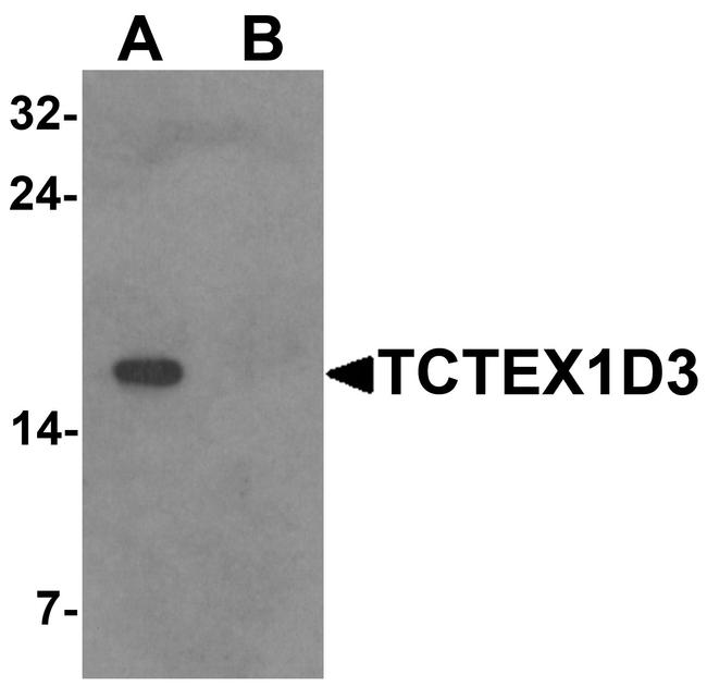 TCTEX1D3 Antibody in Western Blot (WB)