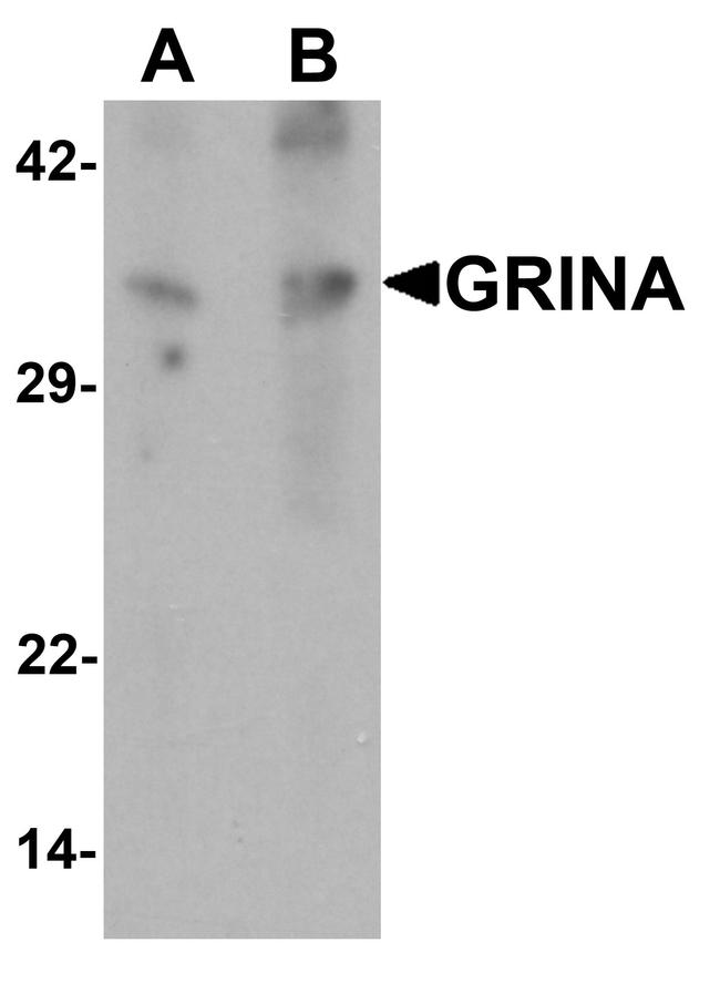 GRINA Antibody in Western Blot (WB)