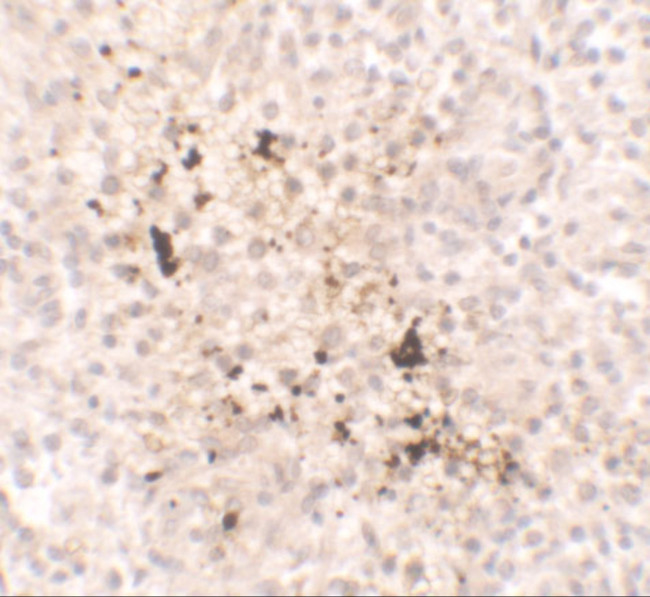 IL-15 Antibody in Immunohistochemistry (IHC)