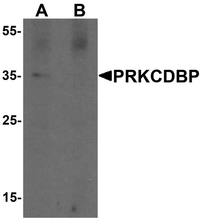 PRKCDBP Antibody in Western Blot (WB)